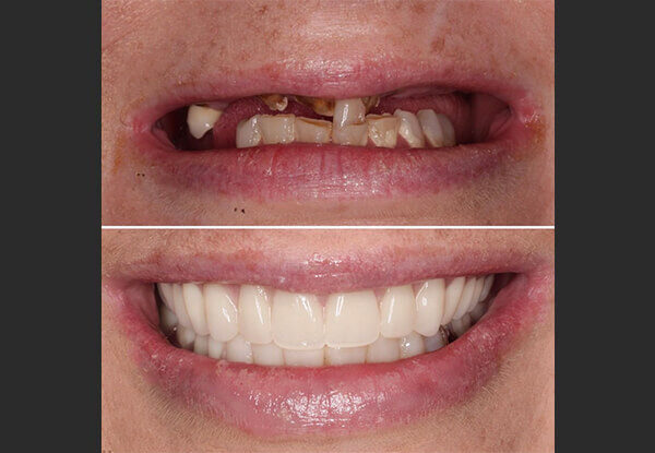 before/after dental treatment