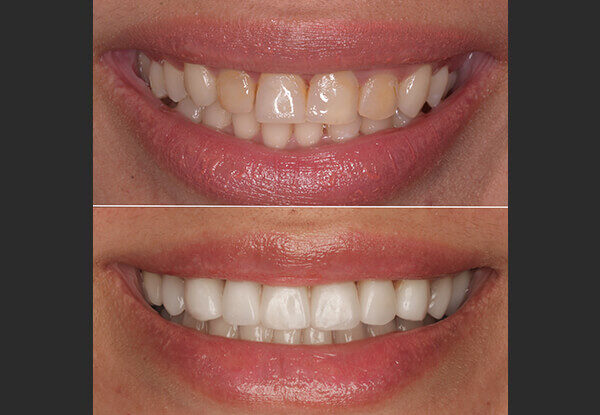 before/after dental treatment